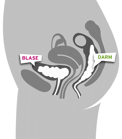 Gelangen bestimmte Bakterien in die Blase, lösen sie dort eine Blasenentzündung aus.